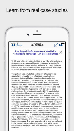 ICU Pearls (Critical Care Tips for Doctors and Nurses)