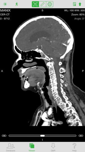 OsiriX HD