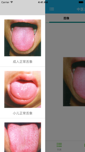 中医舌诊大全